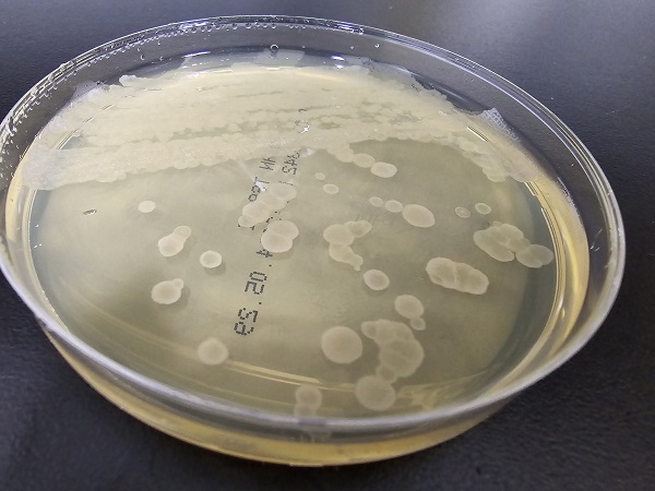 培养基灭菌方法及影响灭菌因素分析