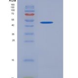 人KIR2DL1 / CD158a重组蛋白Fc tag