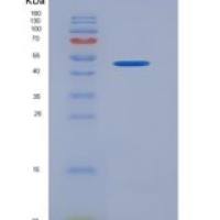 人KIR2DL1 / CD158a重组蛋白Fc tag