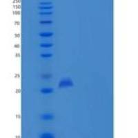 小鼠PLA2G12B / PLA2G13重组蛋白His tag