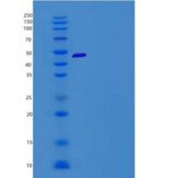 小鼠CD200R4 / CD200 Receptor 4 / CD200RLa重组蛋白Fc tag