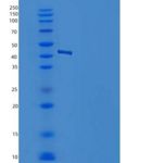 人NSE / ENO2 / Enolase 2重组蛋白His tag