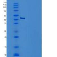 人NSE / ENO2 / Enolase 2重组蛋白His tag