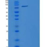 人双肾上腺皮质激素样激酶3(DCLK3)重组蛋白GST tag