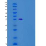 人植酰辅酶a双加氧酶，过氧化物酶体重组蛋白