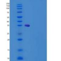 人植酰辅酶a双加氧酶，过氧化物酶体重组蛋白