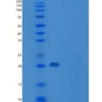 人前列腺素D合酶(PTGDS)重组蛋白His Tag