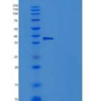 人IL18RAP / IL1R7重组蛋白His tag