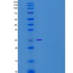 大鼠IL4R / Il4ra重组蛋白His tag