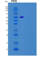 人TRP1 / TYRP1重组蛋白His tag