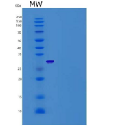 人RPE重组蛋白His Tag