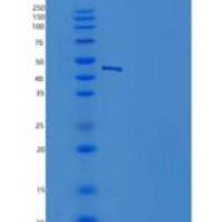 小鼠SerpinB10重组蛋白His tag