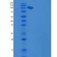 人CHL-1重组蛋白His tag