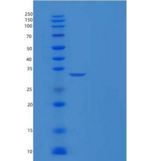 小鼠Carbonic Anhydrase II / Car2重组蛋白His tag