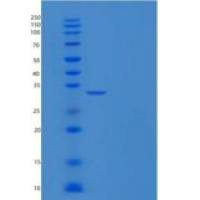 小鼠Carbonic Anhydrase II / Car2重组蛋白His tag