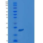 小鼠卷曲同源物10(FZD10)重组蛋白His tag