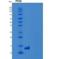 人GP1BB / CD42c重组蛋白His tag