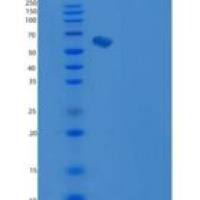 人Endoglin / CD105 / ENG重组蛋白His tag
