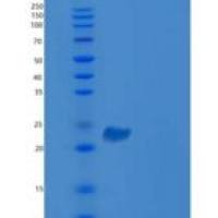人含V-Set免疫球蛋白域蛋白2(VSIG2)重组蛋白His Tag