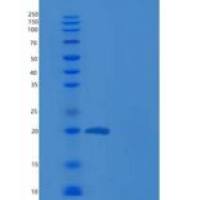 人松弛素-1 / RLN1重组蛋白His tag