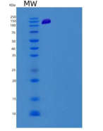 小鼠PKC delta / PRKCD重组蛋白His & G
