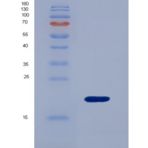 人髓鞘型脂肪酸结合蛋白(FABP8)重组蛋白