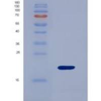 人髓鞘型脂肪酸结合蛋白(FABP8)重组蛋白