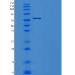 小鼠Meteorin / METRN重组蛋白Fc tag