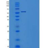小鼠Meteorin / METRN重组蛋白Fc tag