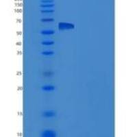 人IL-1R8 / IL1RAPL1重组蛋白Fc tag
