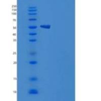 人JNK2 / MAPK9重组蛋白His tag