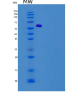 人TWF1 / PTK9 / Twinfilin-1重组蛋白