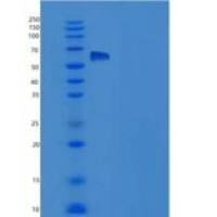 人SLITRK4 / Slitrk4重组蛋白His tag