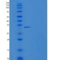 人Shisa同源物3(SHISA3)重组蛋白Fc Tag
