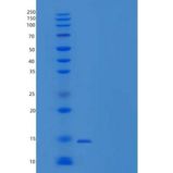 小鼠脂肪酸结合蛋白 4(FABP4)重组蛋白