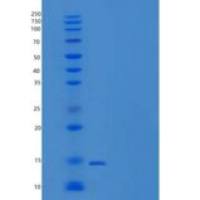 小鼠脂肪酸结合蛋白 4(FABP4)重组蛋白