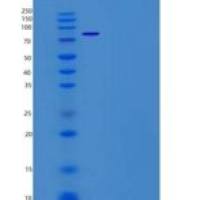 人碱性磷酸酶/ ALPI重组蛋白Fc tag