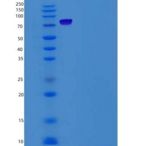 人LRP10重组蛋白Fc tag