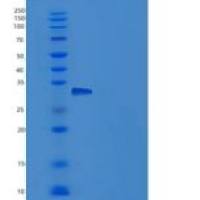 小鼠NEGR1重组蛋白His tag