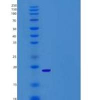 人ALOX5AP / FLAP重组蛋白His tag