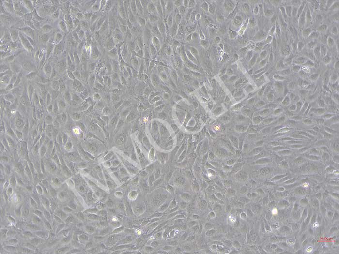 大鼠肾小球内皮细胞丨大鼠原代细胞丨逸漠(immocell)
