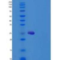 小鼠CXADR / CAR重组蛋白