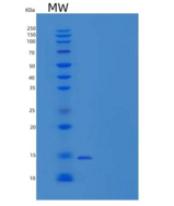 小鼠脂肪酸结合蛋白 4(FABP4)重组蛋白