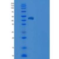 小鼠羧肽酶M(CPM)重组蛋白His Tag