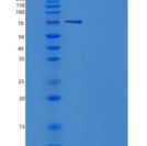 小鼠AKT3重组蛋白aa 106-479, His & GST tag