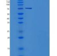 小鼠AKT3重组蛋白aa 106-479, His & GST tag