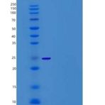 小鼠CD200R4 / CD200 Receptor 4 / CD200RLa重组蛋白His tag