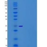 小鼠CD200R4 / CD200 Receptor 4 / CD200RLa重组蛋白His tag