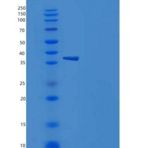 人NETO1 / BTCL1重组蛋白His tag