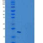 小鼠CRABP2 / CRABPII重组蛋白His tag